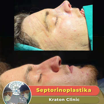 ins image