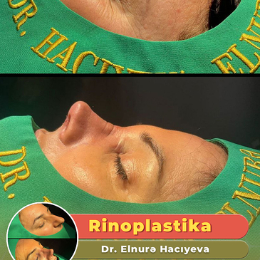 ins image